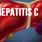 A Complete Guide on Hepatitis C